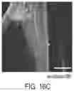 Fig. 17 - MULTICELLULAR INTEGRATED BRAIN TISSUE IN NEUROLOGICAL DISEASES