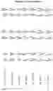 Fig. 14 - Modified recombinant lysosomal alpha-galactosidase A and aspartylglucoaminidase having low mannose-6-phosphate and high sialic acid