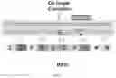 Fig. 14 - COMPOSITIONS AND METHODS FOR TREATING GLYCOGEN STORAGE DISEASE TYPE 1A