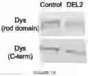 Fig. 02 - METHODS AND MATERIALS FOR ACTIVATING AN INTERNAL RIBOSOME ENTRY SITE IN EXON 5 OF THE DMD GENE