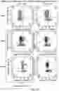 Fig. 29 - Safe harbor loci