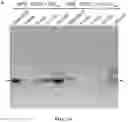 Fig. 83 - Methods for Altering Polypeptide Expression