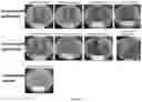 Fig. 03 - A GENETICALLY MODIFIED LACTOBACILLUS AND USES THEREOF