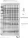 Fig. 08 - LEGHEMOGLOBIN IN SOYBEAN