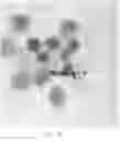 Fig. 06 - A METHOD FOR DETECTING DORMANT OR CELL WALL DEFICIENT MYCOBACTERIUM SPECIES AND A METHOD AND MEDIUM FOR THE GROWTH PROMOTION OF DORMANT OR CELL WALL DEFICIENT FORMS OF MYCOBACTERIUM SPECIES