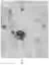 Fig. 07 - A METHOD FOR DETECTING DORMANT OR CELL WALL DEFICIENT MYCOBACTERIUM SPECIES AND A METHOD AND MEDIUM FOR THE GROWTH PROMOTION OF DORMANT OR CELL WALL DEFICIENT FORMS OF MYCOBACTERIUM SPECIES