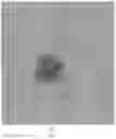 Fig. 09 - A METHOD FOR DETECTING DORMANT OR CELL WALL DEFICIENT MYCOBACTERIUM SPECIES AND A METHOD AND MEDIUM FOR THE GROWTH PROMOTION OF DORMANT OR CELL WALL DEFICIENT FORMS OF MYCOBACTERIUM SPECIES