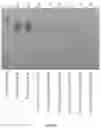 Fig. 03 - AN IMPROVED METHOD OF PREPARING CLINICAL SAMPLES FOR NUCLEIC ACID AMPLIFICATION
