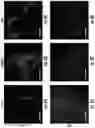 Fig. 10 - METHODS AND COMPOSITIONS FOR PROGNOSTIC AND/OR DIAGNOSTIC SUBTYPING OF PANCREATIC CANCER