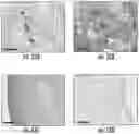 Fig. 14 - METHODS AND COMPOSITIONS FOR PROGNOSTIC AND/OR DIAGNOSTIC SUBTYPING OF PANCREATIC CANCER