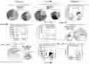 Fig. 16 - METHODS AND COMPOSITIONS FOR PROGNOSTIC AND/OR DIAGNOSTIC SUBTYPING OF PANCREATIC CANCER