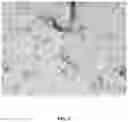 Fig. 07 - Systems and methods for dewatering and drying nanocellulose