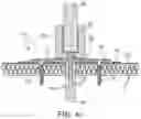 Fig. 04 - Anchor and railing assembly