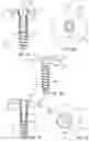 Fig. 08 - Anchor and railing assembly