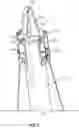 Fig. 03 - Temporary brace system for a structure