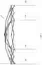 Fig. 05 - Pop-up canopy