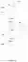 Fig. 11 - Window shade and panel assembly thereof