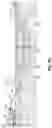 Fig. 09 - Sonic-powered methods for horizontal directional drilling