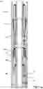 Fig. 18 - SHIFTING TOOL AND ASSOCIATED METHODS FOR OPERATING DOWNHOLE VALVES