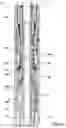 Fig. 22 - SHIFTING TOOL AND ASSOCIATED METHODS FOR OPERATING DOWNHOLE VALVES