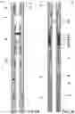 Fig. 27 - SHIFTING TOOL AND ASSOCIATED METHODS FOR OPERATING DOWNHOLE VALVES