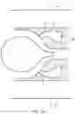 Fig. 03 - PLENUM RESONANCE PREVENTION FOR GAS TURBINE ENGINE