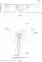 Fig. 05 - Devices and methods for determining deflection of rotor blades of a wind turbine