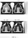 Fig. 10 - Mixed flow fan with enhanced heat dissipation efficiency