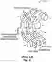 Fig. 18 - Device for increasing flow capacity of a fluid channel