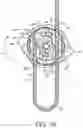 Fig. 11 - Securing device