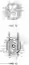 Fig. 16 - Securing device