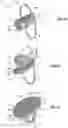 Fig. 02 - Flexible, foldable foreign material exclusion device