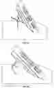 Fig. 07 - Rotatable X shaped folding flip grip