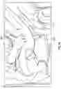 Fig. 24 - Force sensing seat belt sensor assembly