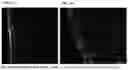 Fig. 03 - TRANSPARENT SKIN SAMPLE