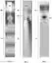 Fig. 03 - REFRACTIVE-INDEX SENSOR AND METHOD