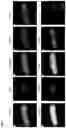 Fig. 02 - CCR5-BASED METHODS FOR PREDICTING OVERALL AND PROGRESSION FREE SURVIVAL IN SUBJECTS HAVING CANCER
