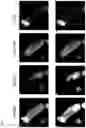 Fig. 15 - CCR5-BASED METHODS FOR PREDICTING OVERALL AND PROGRESSION FREE SURVIVAL IN SUBJECTS HAVING CANCER