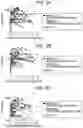 Fig. 12 - Method for acquiring information on respiratory infection