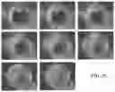 Fig. 22 - MICROARRAY COMPOSITIONS AND METHODS OF THEIR USE