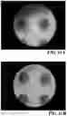 Fig. 31 - MICROARRAY COMPOSITIONS AND METHODS OF THEIR USE