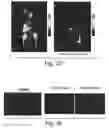 Fig. 04 - Methods and products for in vivo enzyme profiling