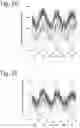 Fig. 05 - Method for the diagnosis and treatment of essential primary hypertension