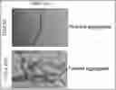 Fig. 01 - Method and kit for discriminating between parkinson's disease and multiple system atrophy