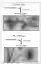 Fig. 04 - Method and kit for discriminating between parkinson's disease and multiple system atrophy