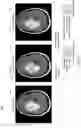 Fig. 06 - Deep learning based magnetic resonance imaging (MRI) examination acceleration