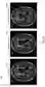 Fig. 07 - Deep learning based magnetic resonance imaging (MRI) examination acceleration