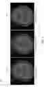 Fig. 08 - Deep learning based magnetic resonance imaging (MRI) examination acceleration