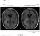 Fig. 09 - Deep learning based magnetic resonance imaging (MRI) examination acceleration