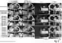 Fig. 12 - Free-breathing MRI with motion compensation
